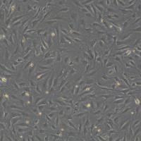 人脐静脉细胞融合细胞  EA.hy926