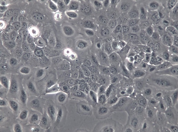 CaSki细胞价格货期STR鉴定