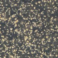 急性B淋巴细胞白血病 SUPB15