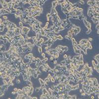 人食管鳞癌细胞 KYSE-70