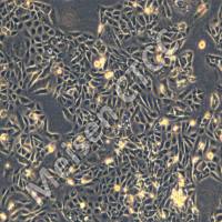 人胰腺导管腺癌细胞 PL45