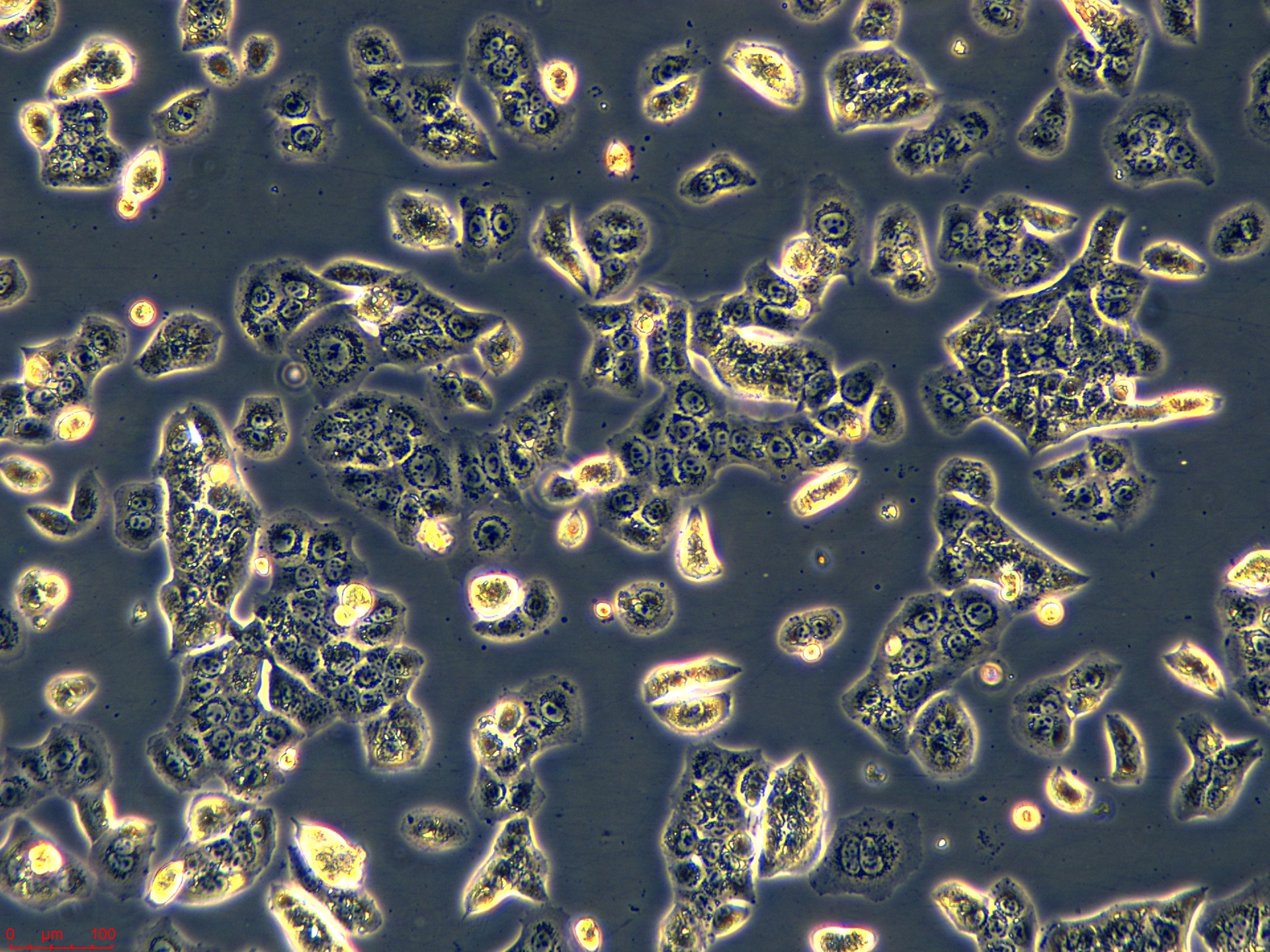 Project_NCI-H820_ch00 (2).jpg