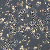 非小细胞肺癌细胞 NCIH2110