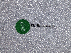 CCRF-CEM悬浮生长扩增分瓶