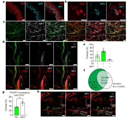 《Nature》：组织透明化成像结合单细胞测序揭示交感神经肽Y（NPY）通过维持产热脂肪抑制肥胖