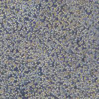 成人急性髓系白血病细胞 SKM-1