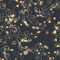 鳞状细胞癌，扁平上皮癌细胞 SNU-1066