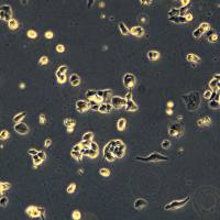 非小细胞肺癌细胞 NCI-H522