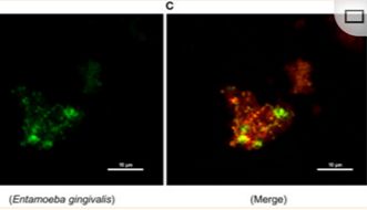 微生物生物膜FISH检测