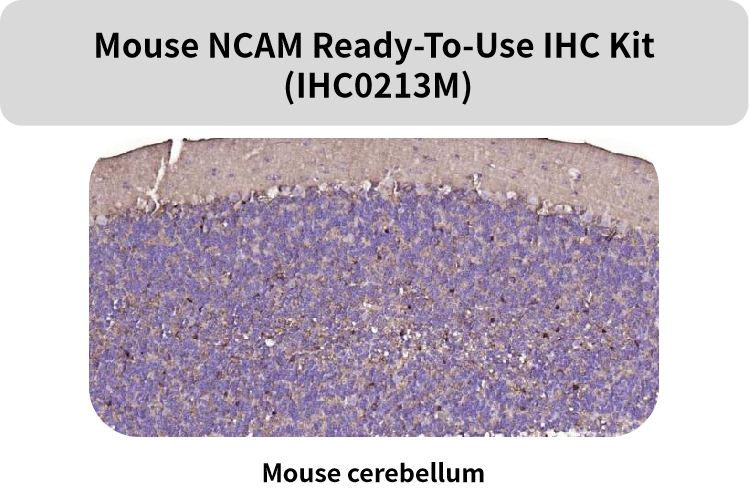 Bioss即用型IHC KIT上新及常见神经细胞标志物(三)