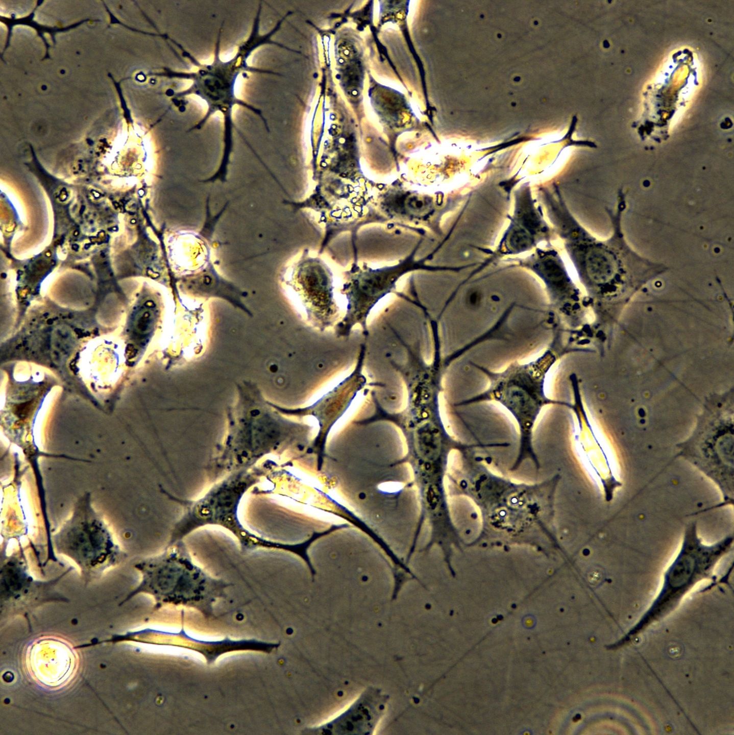 人眼葡萄膜黑色瘤細胞 MP46