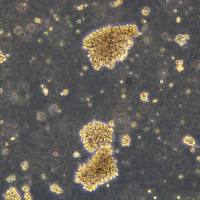 人多发性骨髓瘤细胞 HuNS1