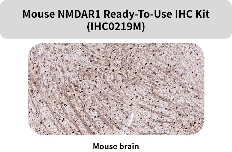 Bioss即用型IHC KIT上新及常见神经细胞标志物(三)