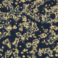 人非小细胞肺癌细胞 NCI-H358