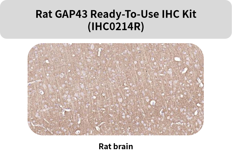 Bioss即用型IHC KIT上新及常见神经细胞标志物(三)