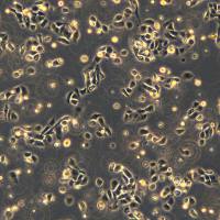 鳞状细胞癌 扁平上皮癌细胞 SNU-1076