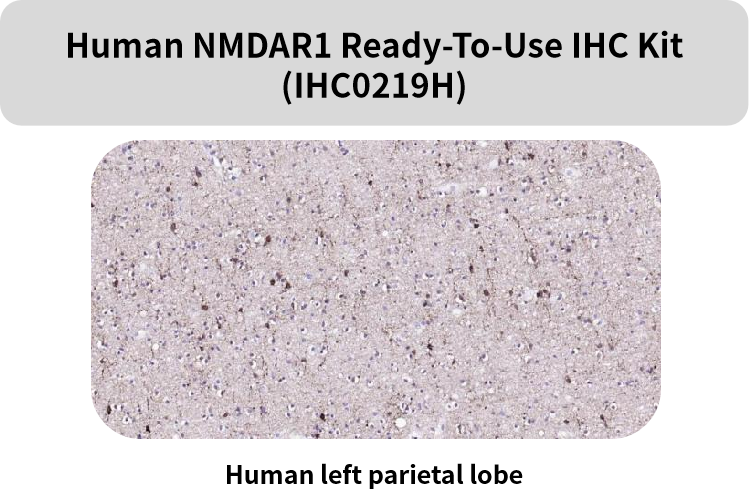 Bioss即用型IHC KIT上新及常见神经细胞标志物(三)