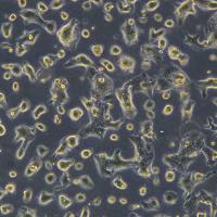 人舌鳞癌细胞 UPCI-SCC-152