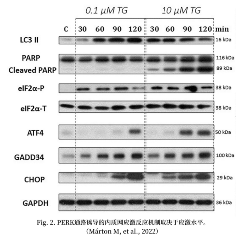 解锁科研利器：Hoefer Western Blotting组合的强大潜能