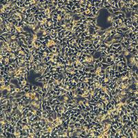 小鼠黑色素瘤细胞-mcherry标记 B16-F10-mcherry