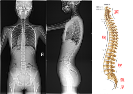 精准解码脊柱动态密码： 三维红外运动分析技术开启无创诊断新时代