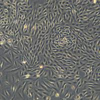 人永生化正常乳腺上皮细胞 MCF 10F