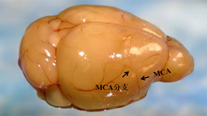 小鼠电阻断脑中动脉致脑梗死造模方法