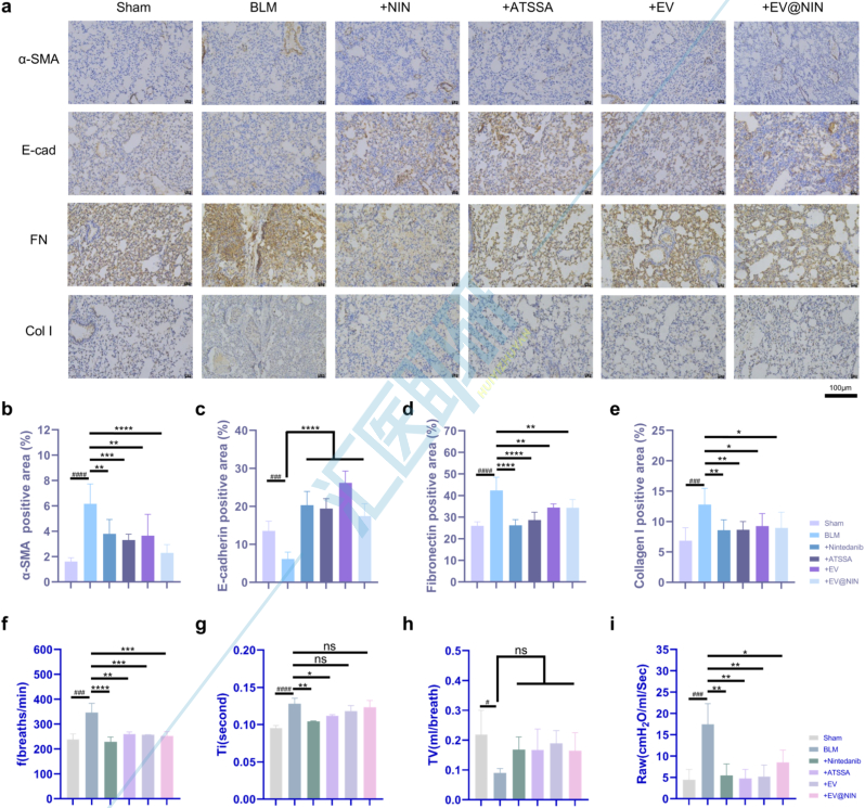 图6.ATSSA、EV和EV@NIN在体内对BLM诱导的肺纤维化有治疗作用。