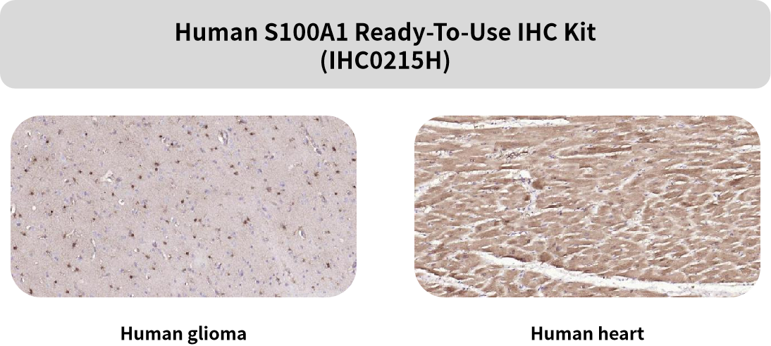Bioss即用型IHC KIT上新及常见神经细胞标志物(三)