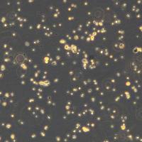 人直肠腺癌细胞 SW1463