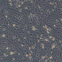  人原代心肌成纤维细胞