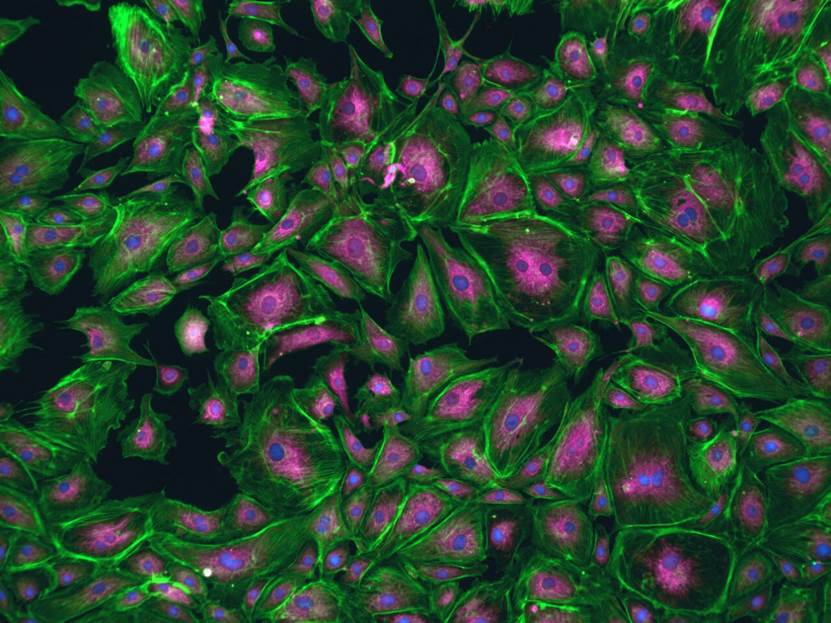 许多绿色的植物

AI 生成的内容可能不正确。