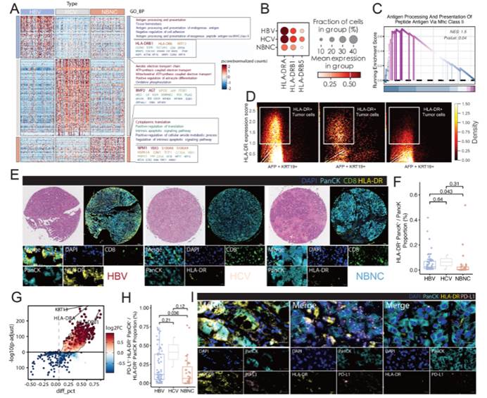 Tissue Cytometry技术揭示HLA-DR⁺肿瘤细胞导致病毒性肝癌微环境免疫耗竭的作用机制