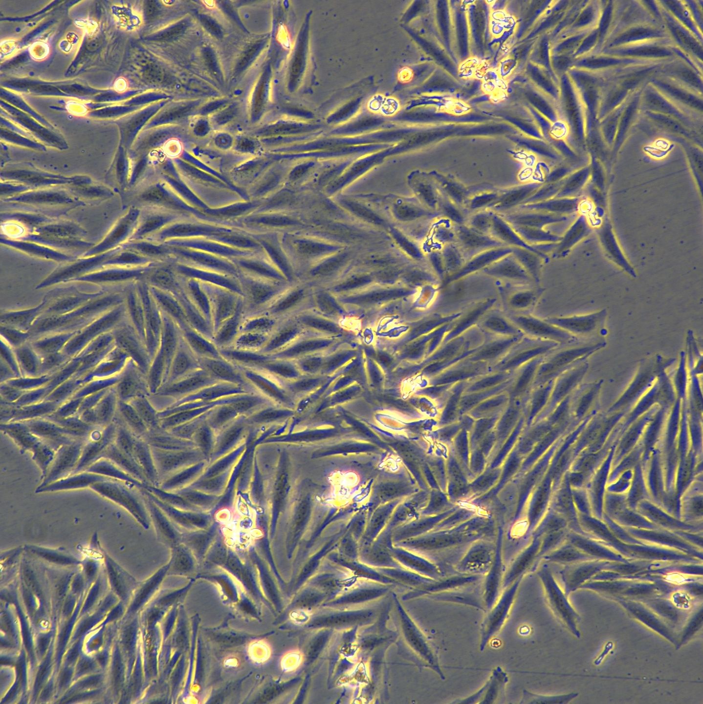 人骨肉瘤细胞 Saos-2