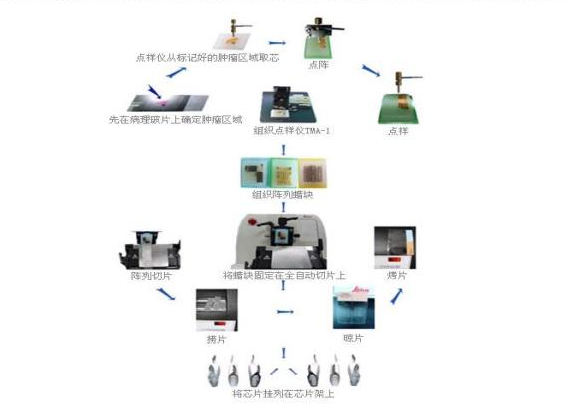 胃腺癌及胃组织组合芯片