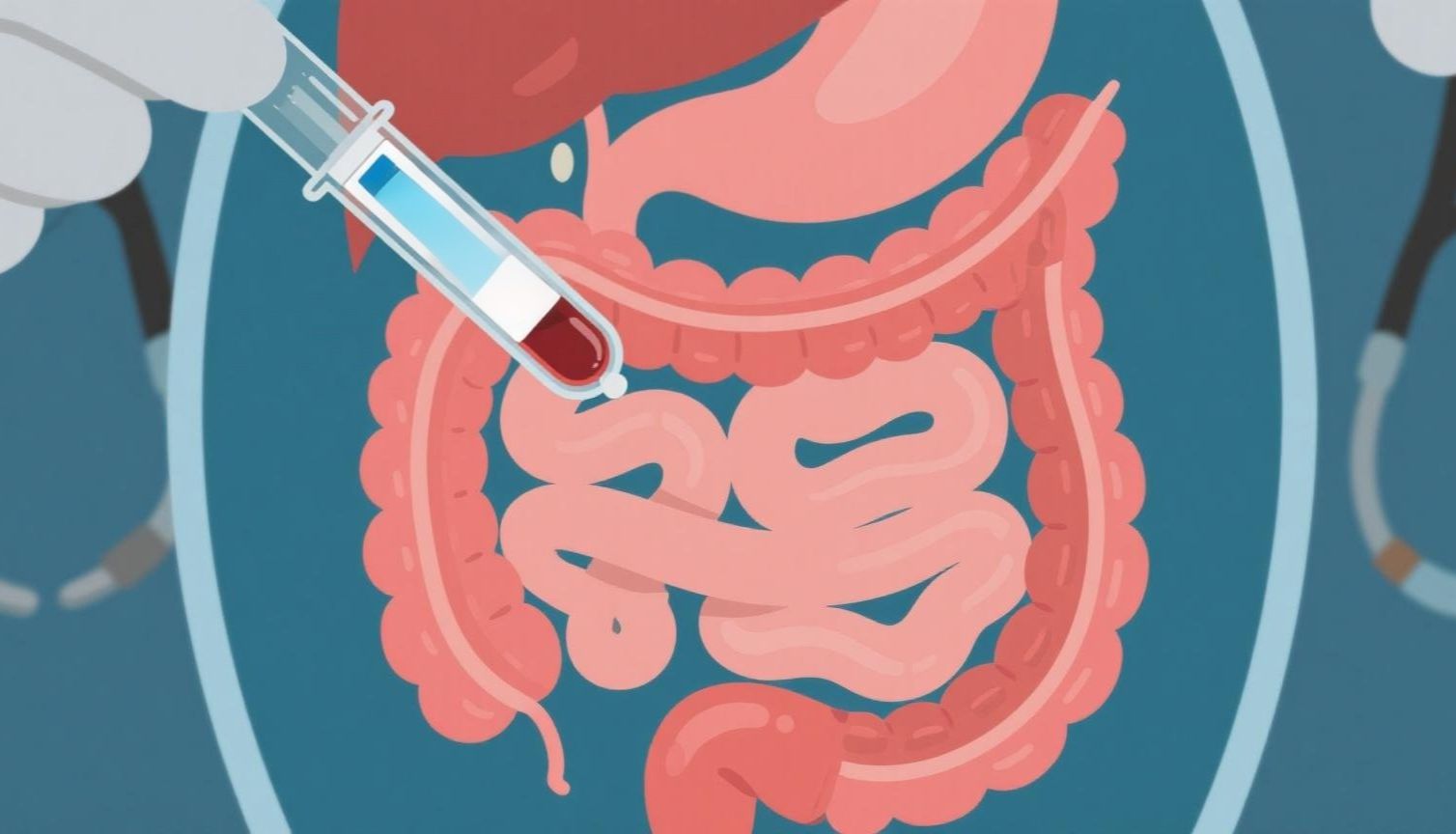 乌司奴单抗谷浓度可预测克罗恩病疗效 ——内镜缓解率与血药水平显著相关