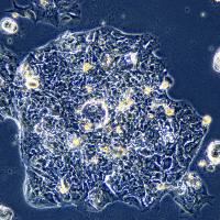 卵巢癌细胞 Caov4