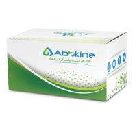 CheKine™ 总胆汁酸（TBA）含量检测试剂盒（微量法）