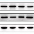 Western Blot实验(整模)