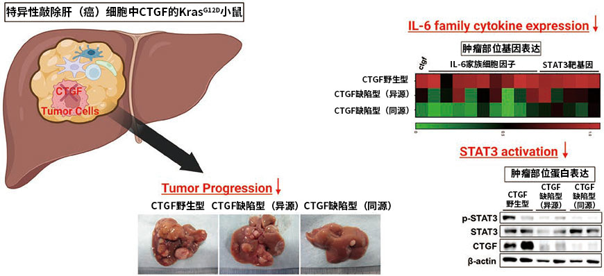 CTGF和STAT3介导的肿瘤间质反应引发的肝癌增大发展机制