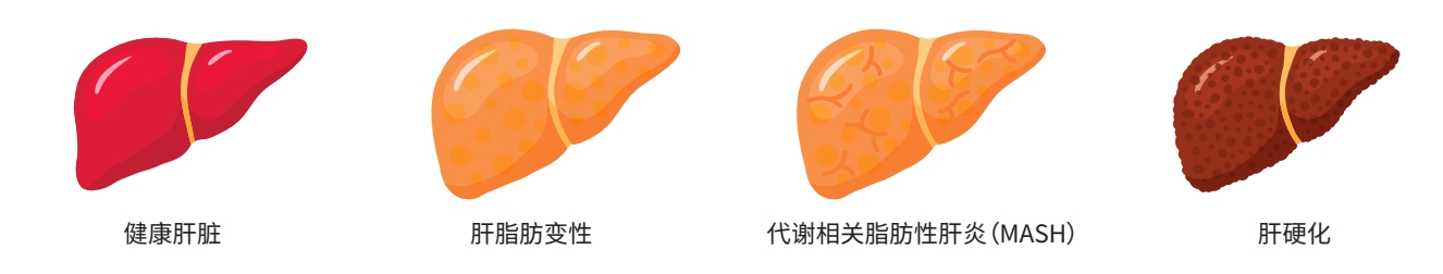 MAFLD临床试验中的角蛋白18——死亡细胞仍然重要!