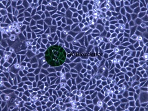 Eca-109细胞价格货期STR鉴定