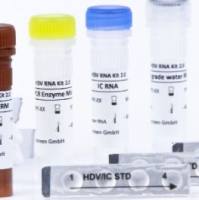 RoboGene 定量诊断HDV RNA试剂盒2.0