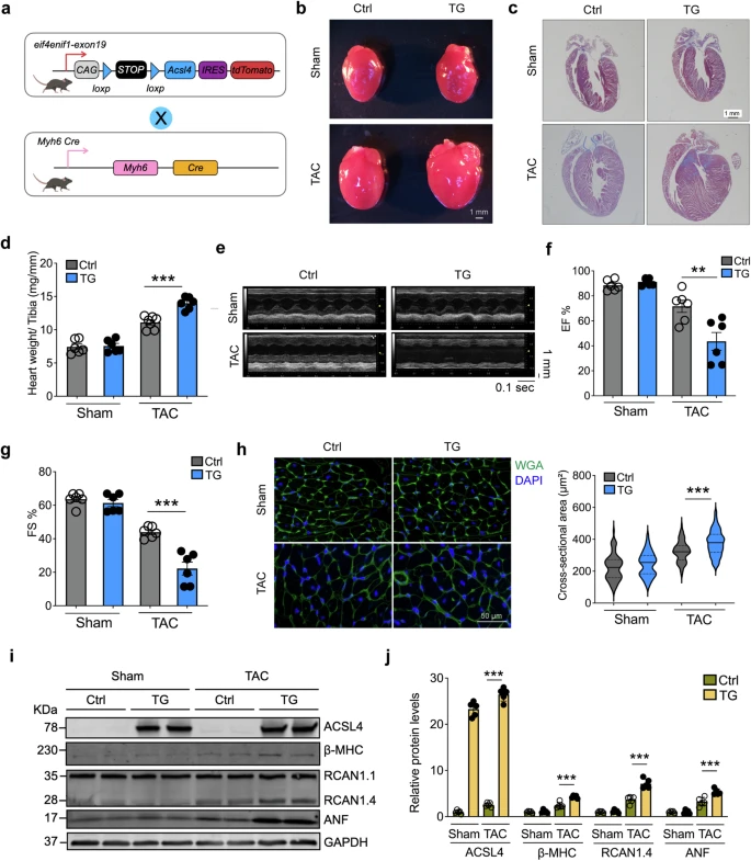 顶刊思维 | STTT重磅！铁死亡携手多组学，揭示心衰治疗新靶点