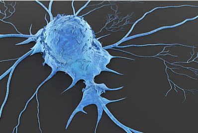 人神经上皮瘤细胞常见问题与解决方案