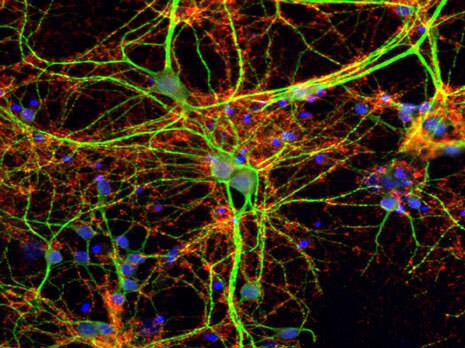 荧光探针基团选择指南：满足荧光检测和定量分析研究需求-赛默飞