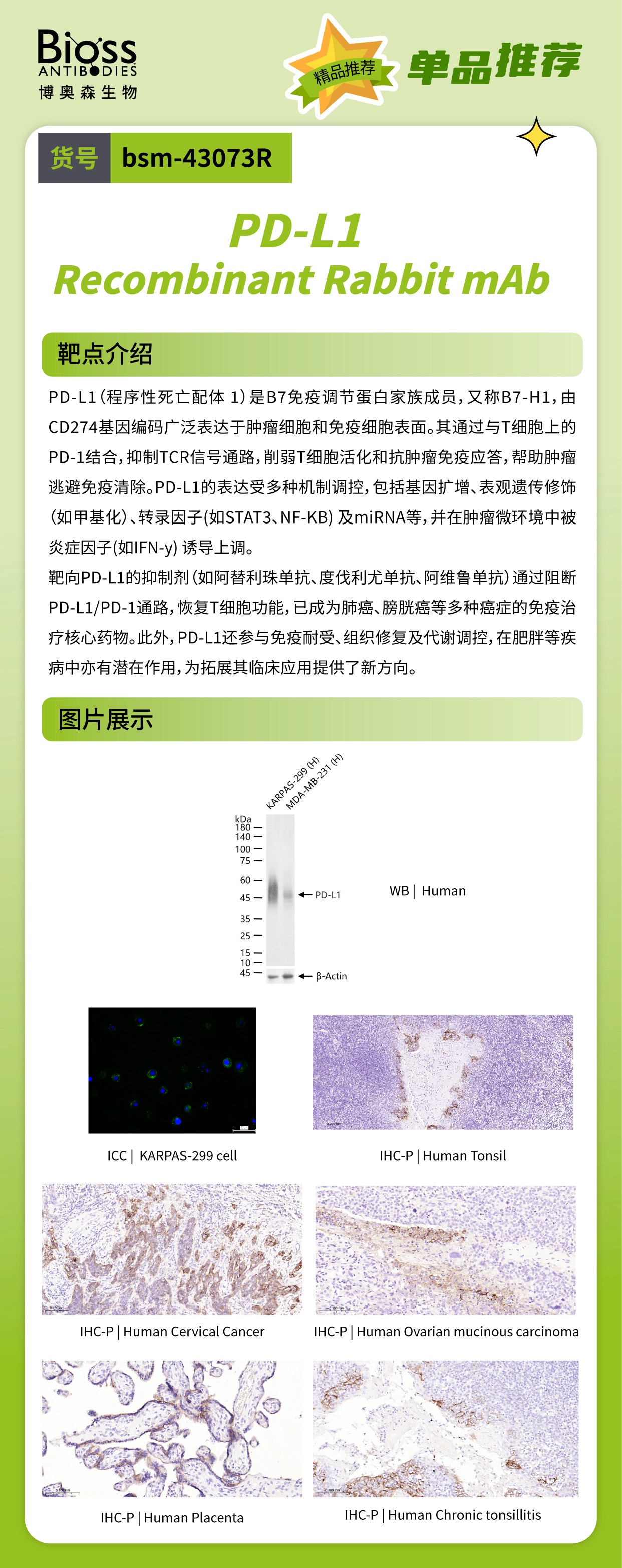 Bioss 星推荐 | PD-L1 抗体