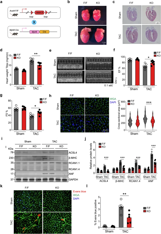 顶刊思维 | STTT重磅！铁死亡携手多组学，揭示心衰治疗新靶点
