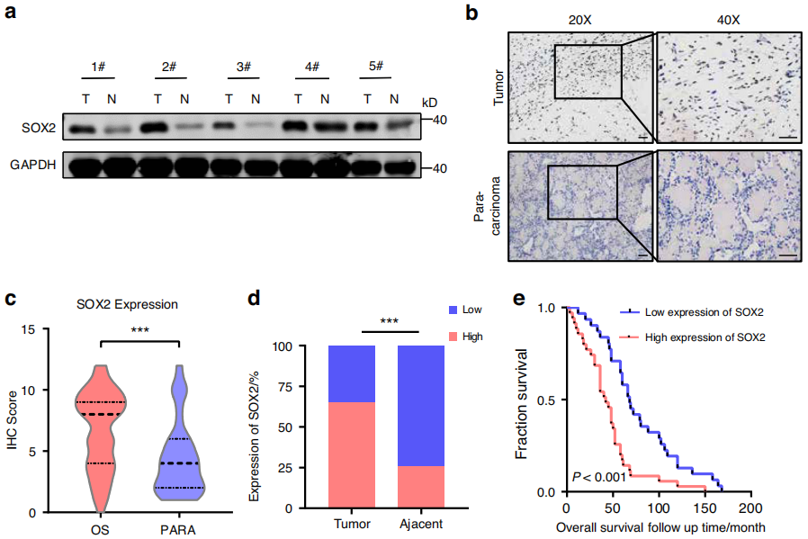 Bone Research丨揭秘骨肉瘤耐药：AKT抑制剂与化疗药物联合治疗新突破