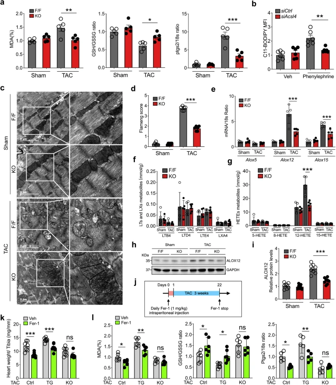 顶刊思维 | STTT重磅！铁死亡携手多组学，揭示心衰治疗新靶点